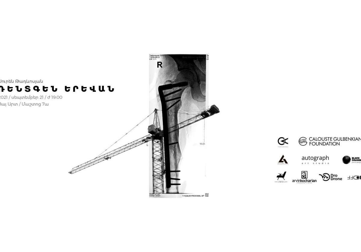 «Ռենտգեն Երևան»․ քաղաքի թաքնված շերտերը